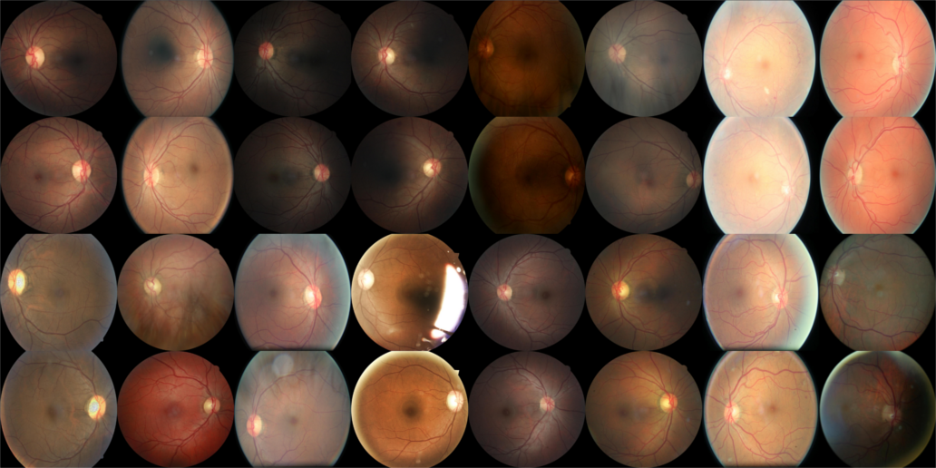 Input layer without augmentations and normal rescaling. Labels (from left to right, up to down): 0, 0, 0, 2, 1, 0, 4, 0, 1, 0, 0, 2, 2, 0, 4, 0, 0, 0, 0, 0, 0, 2, 2, 0, 0, 0, 0, 0, 0, 2, 3, 0. Click for larger image (4.5MB).